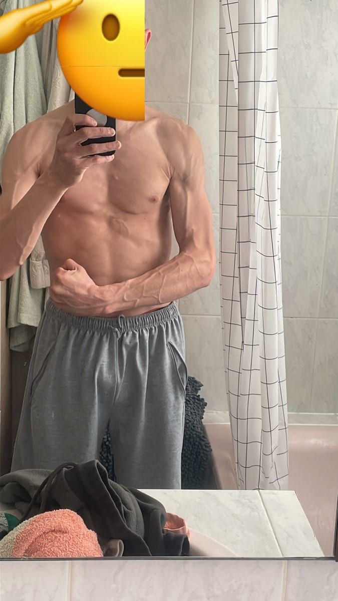 Profil de Fortunato